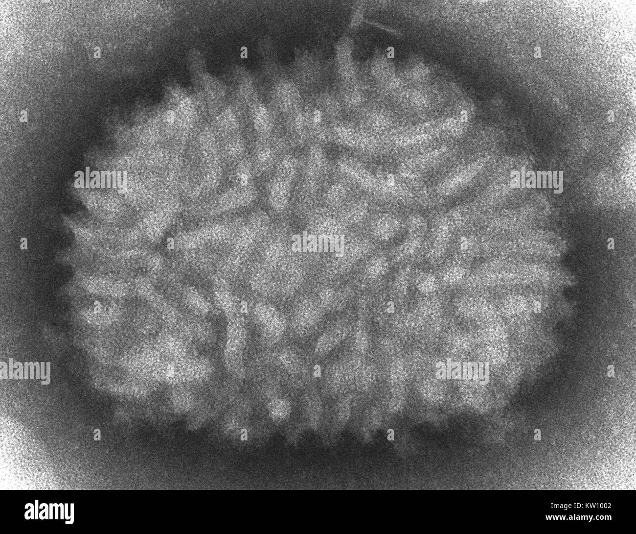Un micrografico elettronico di un virus del vaiolo vaccino. Il virus del vaiolo vaccino è normalmente limitata ai bovini, ma viene convogliato agli esseri umani attraverso la vaccinazione, e in tal modo conferire immunità al virus del vaiolo. Immagine cortesia CDC/Cynthia Goldsmith, 2002. Foto Stock