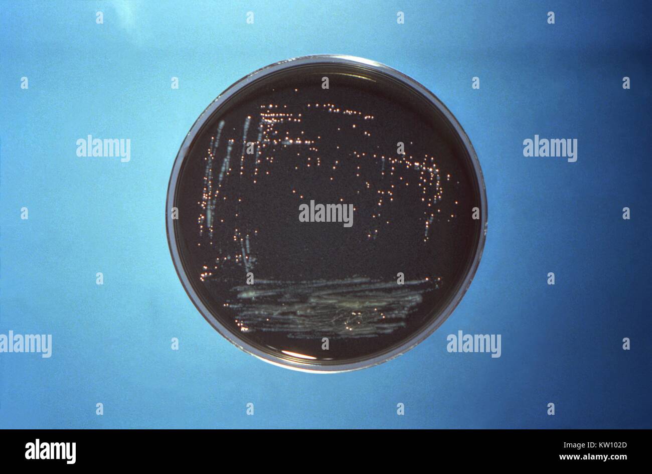 La piastra di Petri piastra di coltura qui raffigurato, contenuto di carbone estratto di lievito (CYE) medio su cui numerose Legionella pneumophila colonie batteriche erano state coltivate. Legionella pneumophila cresce bene su questo mezzo, e le colonie assumono una forma circolare, off-bianco modello di crescita. Immagine cortesia CDC/Dott. Jim Feeley, 1977. Foto Stock