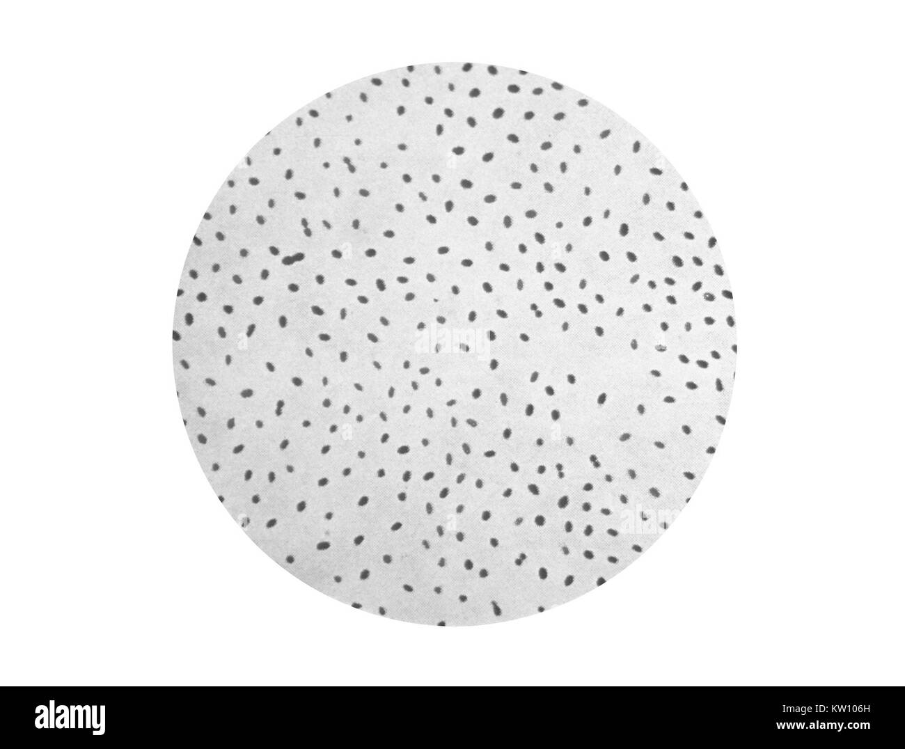 Questa è una illustrazione di una fotomicrografia del batterio Brucella melitensis, inizialmente denominato Micrococcus melitensis . Questa è una fotomicrografia di Brucella melitensis, la causa della brucellosi. I sintomi sono simili a quelli influenzali e può includere anche gravi infezioni del sistema nervoso centrale e il rivestimento del cuore, o endocardio. Immagine cortesia CDC, 1979. Foto Stock