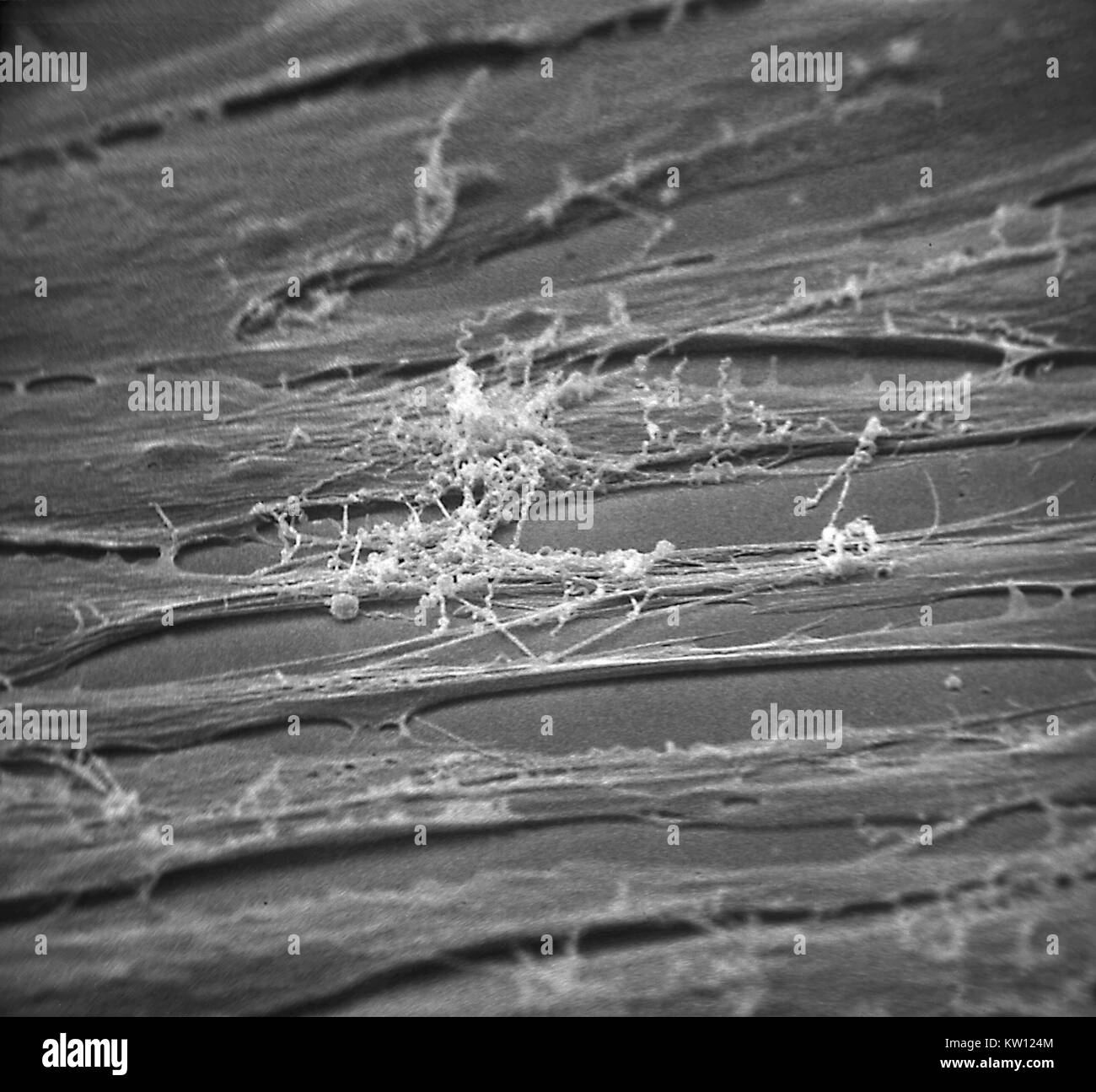 Micrografia elettronica di Treponema pallidum su colture di cotone-coda di coniglio di cellule di epitelio (SF1Ep). Treponema pallidum è l'agente eziologico della sifilide. Negli Stati Uniti, oltre 35, 600 casi di sifilide sono stati riportati da funzionari della sanità nel 1999. Immagine cortesia CDC/Dott. David Cox, 1980. Foto Stock