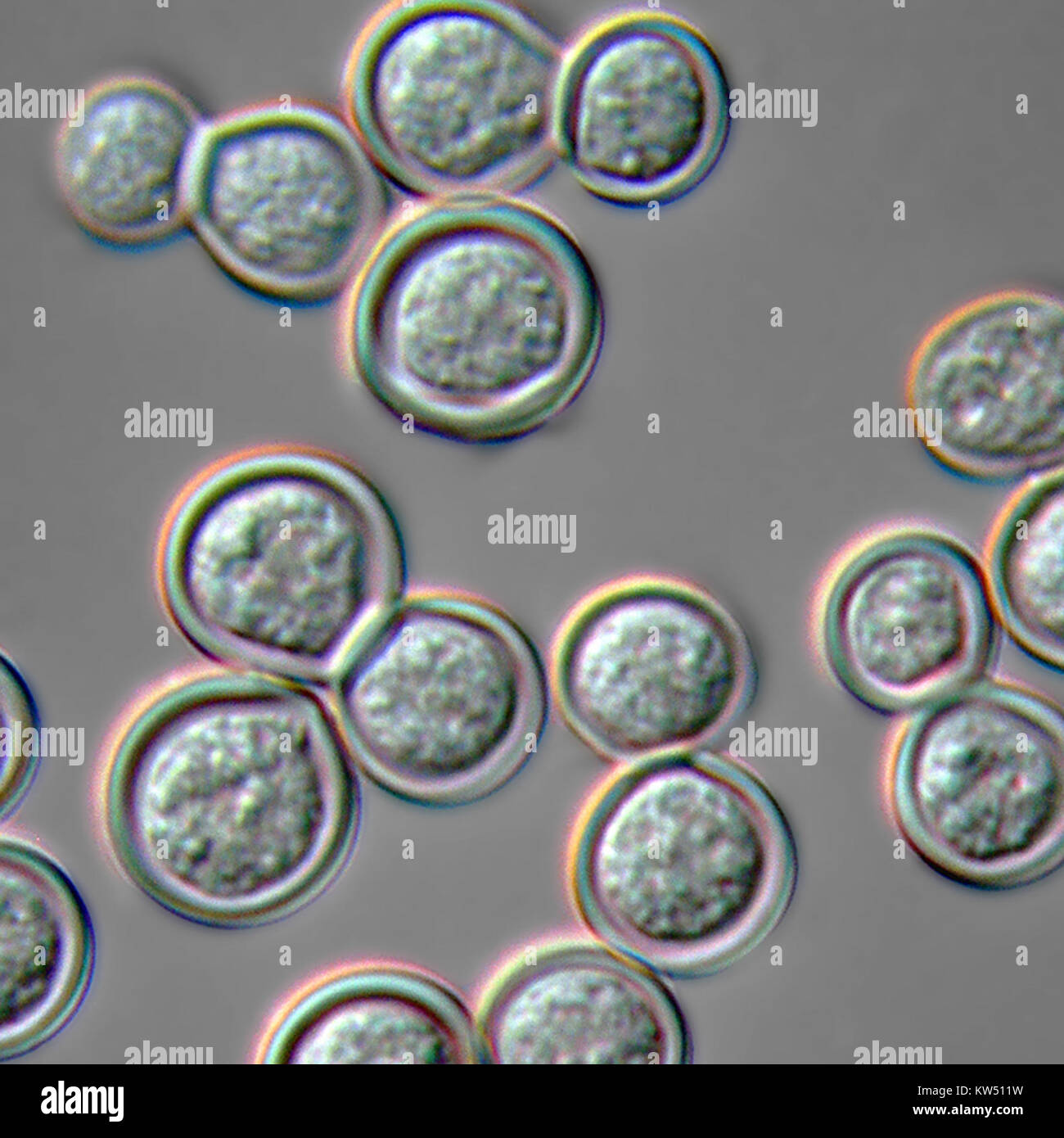 Blastomyces dermatitidis è un fungo responsabile dell'infezione blastomicosi. La sua forma di lievito si trova in genere nel suolo o nella materia organica in decadimento e può infettare l'uomo e gli animali quando inalato. Foto Stock Blastomyces dermatitidis è un fungo responsabile dell'infezione blastomicosi. La sua forma di lievito si trova in genere nel suolo o nella materia organica in decadimento e può infettare l'uomo e gli animali quando inalato. Foto Stock