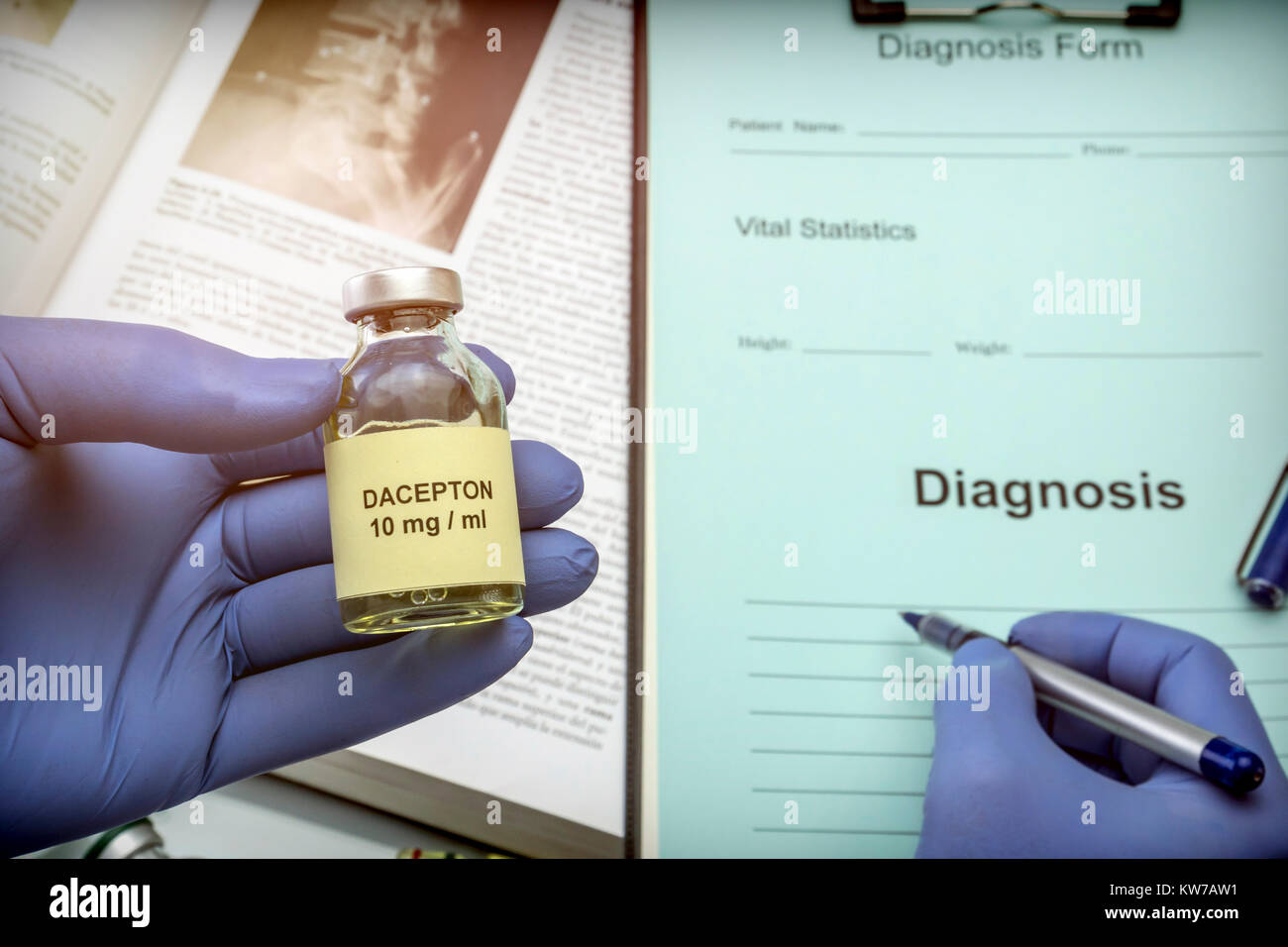 Medico oggetto flaconcino con farmaci per il trattamento del morbo di Parkinson in un ospedale, immagine concettuale Foto Stock