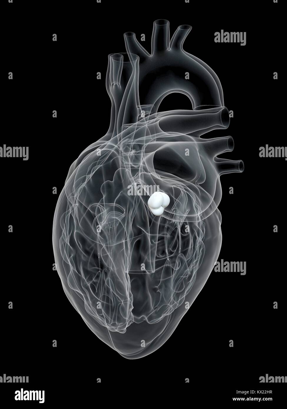 Cuore umano che mostra la valvola aortica, illustrazione. Foto Stock