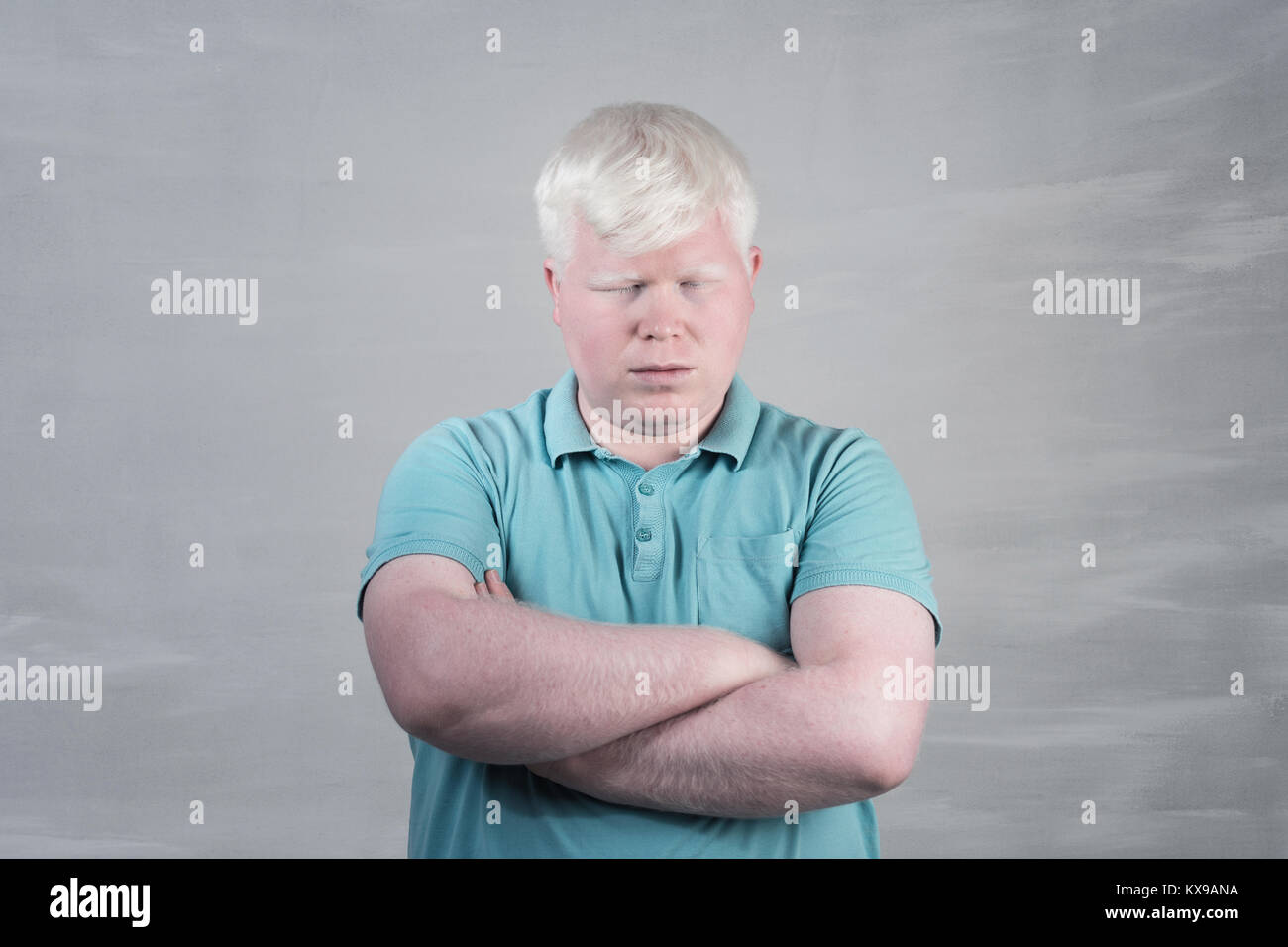 Albino giovane uomo ritratto. Ragazzo biondo isolato a sfondo grigio. L'albinismo Foto Stock