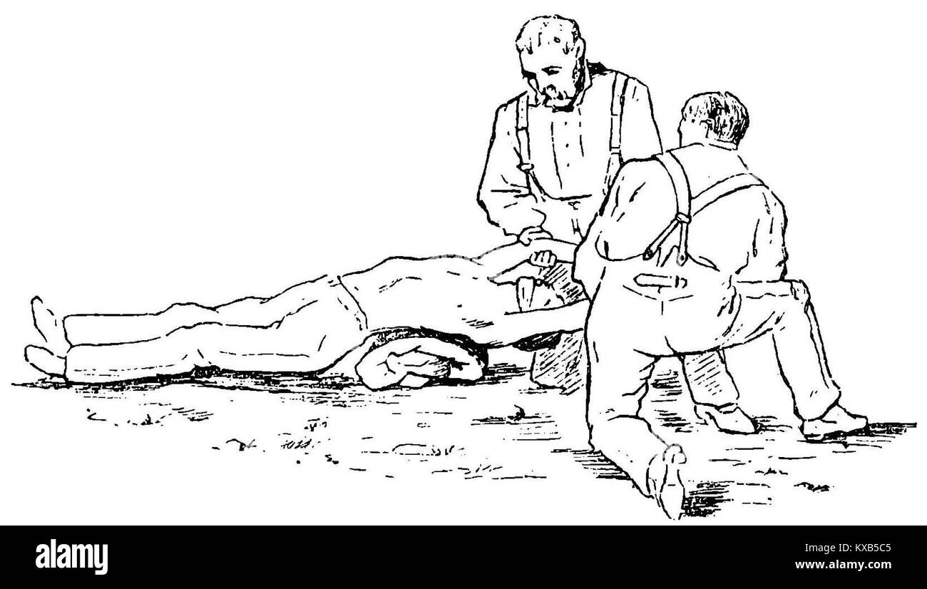 Fotografia che raffigura il metodo Silvestre della respirazione artificiale, che mostra due soggetti che eseguono le prime tecniche di rianimazione manuale volte a rianimare i pazienti incoscienti. Foto Stock