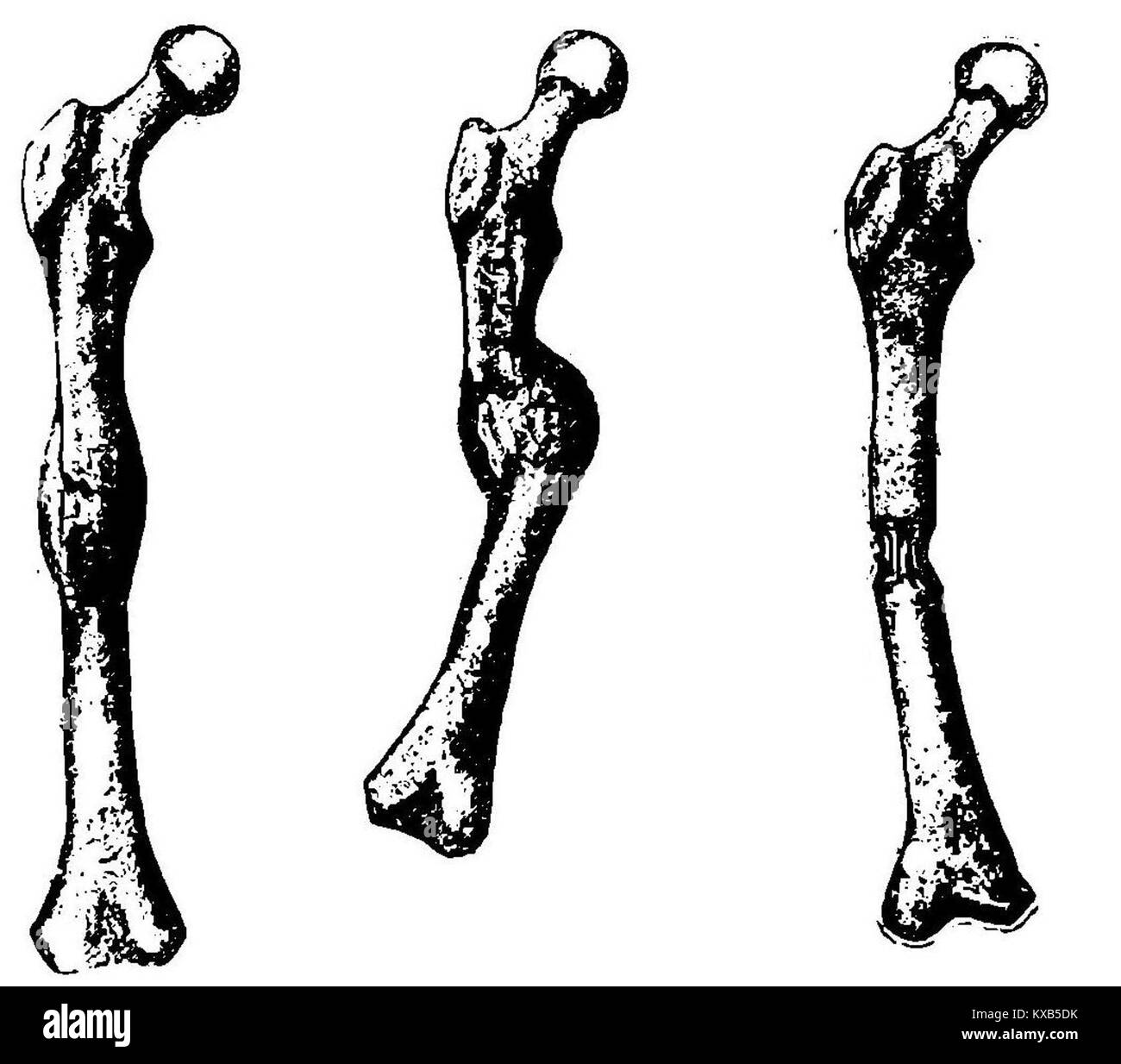 Testo medico Grierson 36 che discute la guarigione della frattura ossea, le fasi di recupero, i trattamenti chirurgici e gli interventi terapeutici per la rigenerazione ossea. Foto Stock