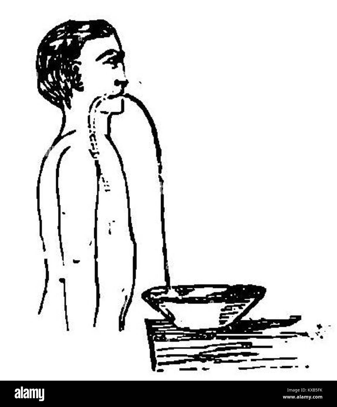 Un'illustrazione medica che raffigura la lavanda dello stomaco, mostrando la procedura per la pulizia dello stomaco, utilizzata nel trattamento dell'avvelenamento e di altre condizioni gastrointestinali. Foto Stock