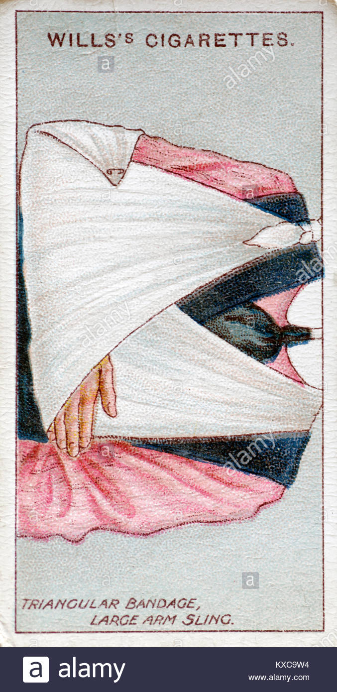 Vintage di primo soccorso - Illustrazioni Trangular bendaggio, braccio grande imbracatura Foto Stock