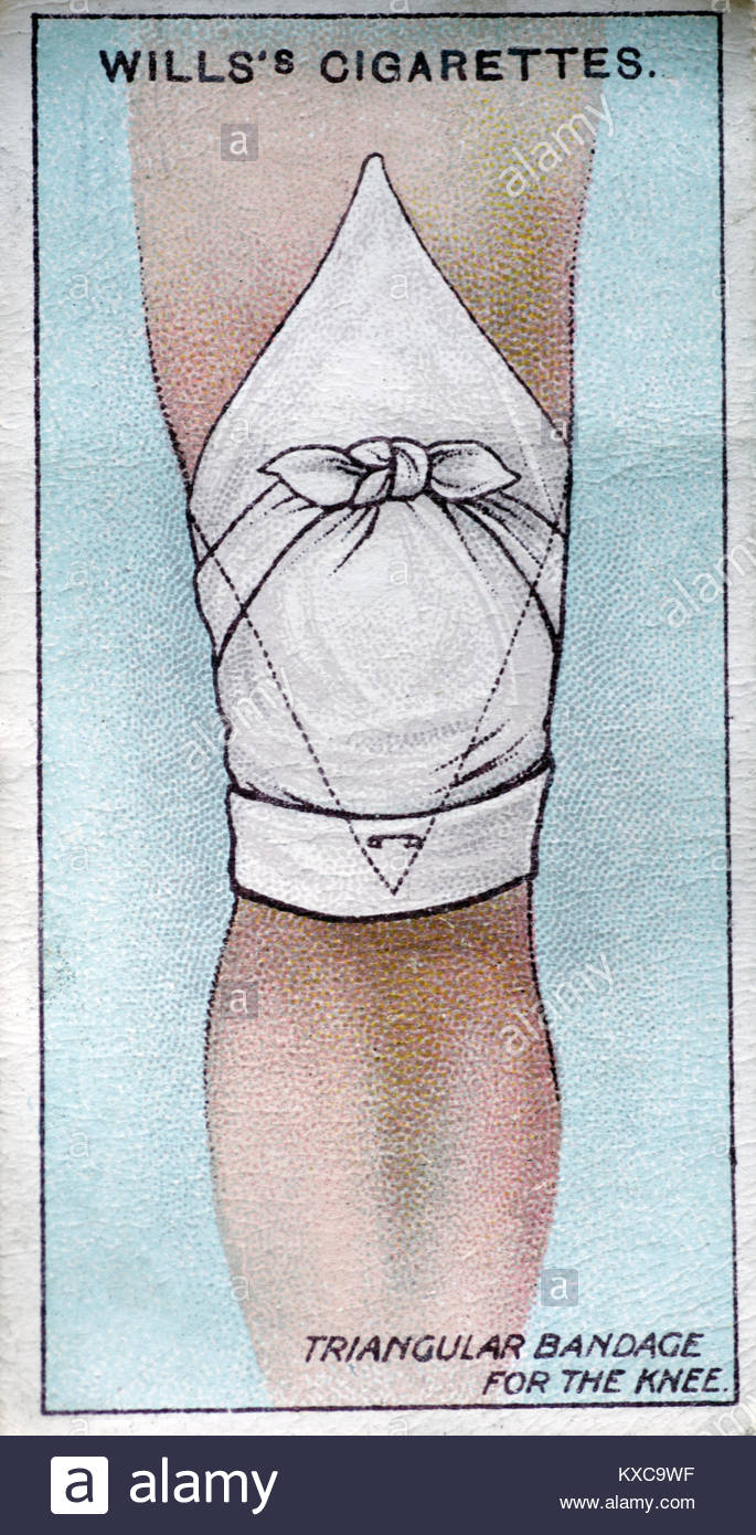Vintage primo aiuto illustrazioni - bendaggio triangolare per il ginocchio Foto Stock