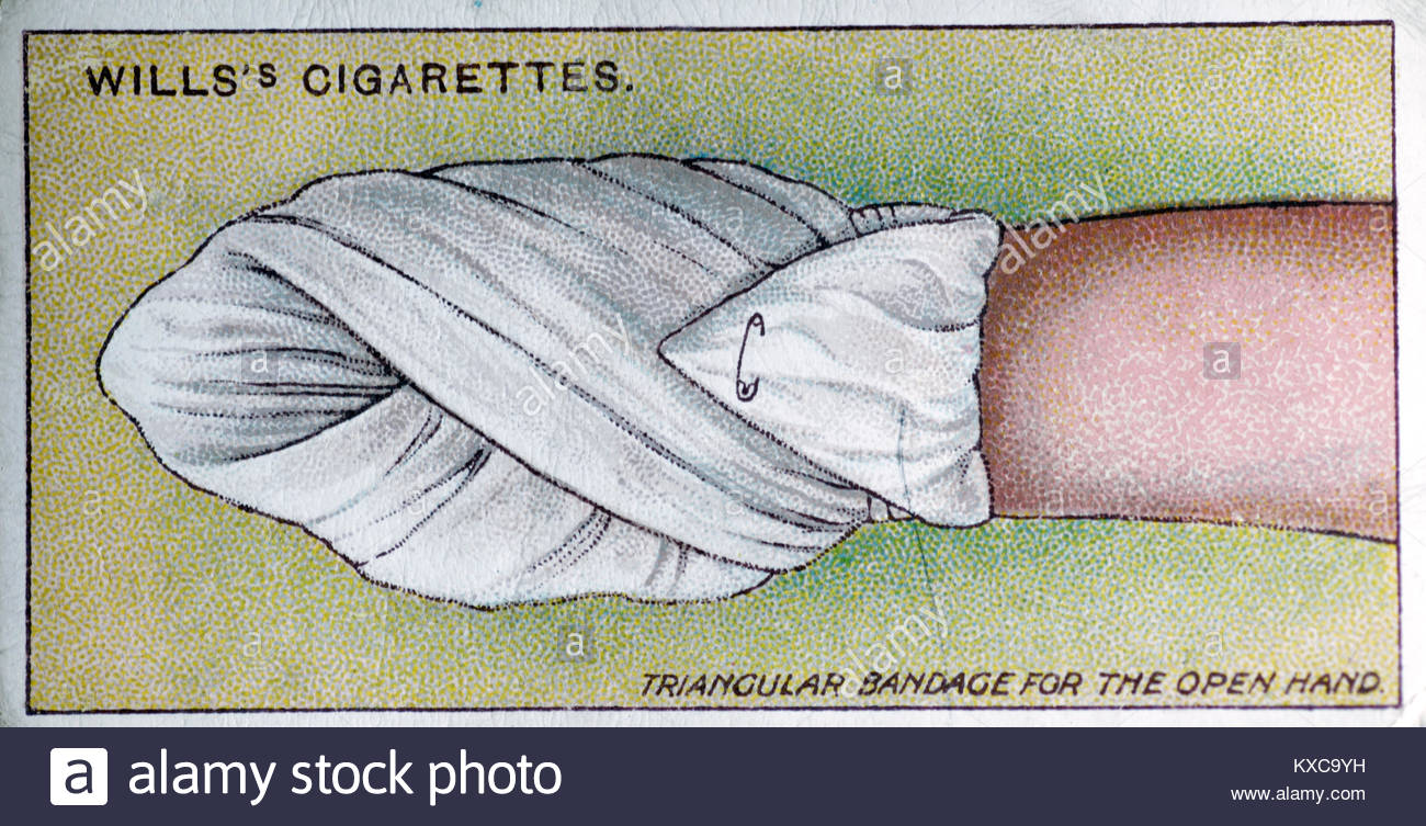 Vintage primo aiuto illustrazioni - bendaggio triangolare per la mano aperta Foto Stock