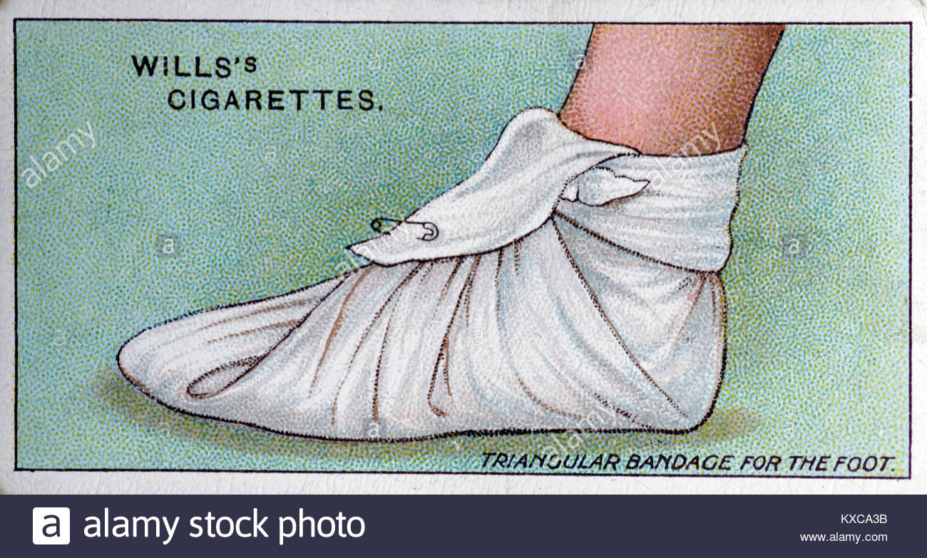 Vintage primo aiuto illustrazioni - bendaggio triangolare per il piede Foto Stock