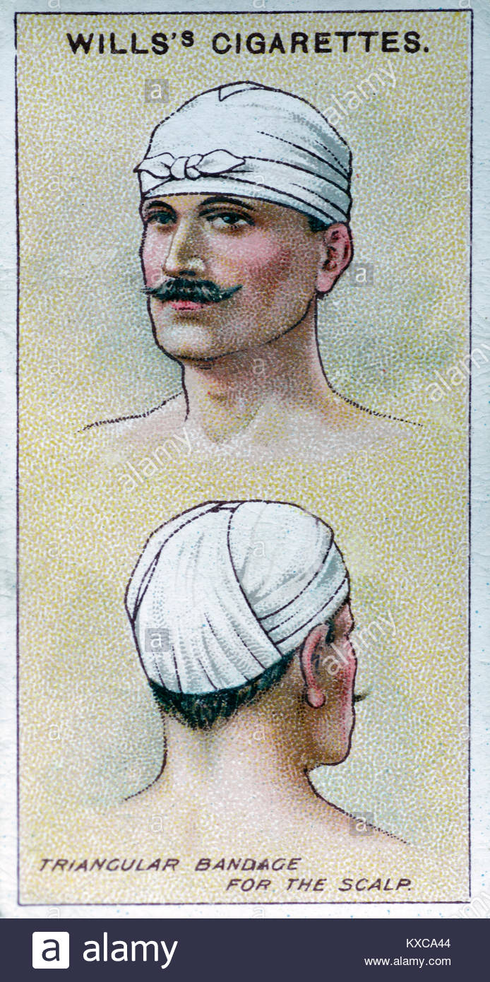 Vintage primo aiuto illustrazioni - bendaggio triangolare per il cuoio capelluto Foto Stock