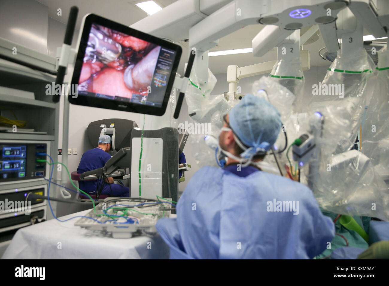Il Duca di Cambridge (sullo sfondo a sinistra) guarda attraverso una doppia console di da Vinci robot mentre piombo chirurgo Vin Paleri conduce un manipolatore robotico assistita della base del timone hemiglossectomy intervento chirurgico sul paziente Anne bianco, 67, durante la sua visita al Royal Marsden NHS Foundation Trust di Londra. Foto Stock