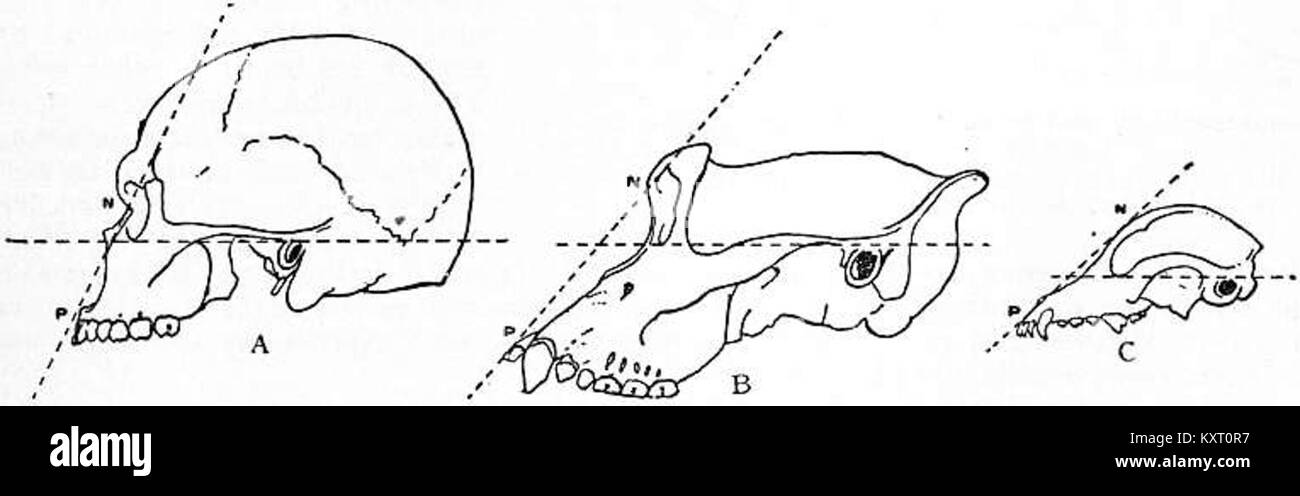 EB1911 Craniometry - Fig. 7.-angoli facciali dell'accordo di Francoforte Foto Stock