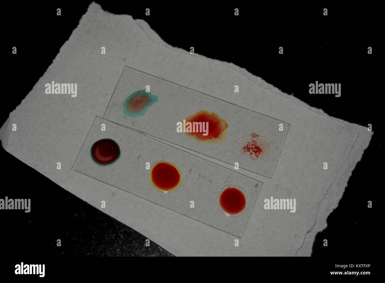 Campione di sangue sulla diapositiva per osservare il gruppo sanguigno Foto Stock