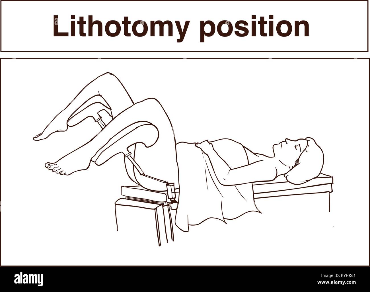 Posizione di litotomia Illustrazione Vettoriale