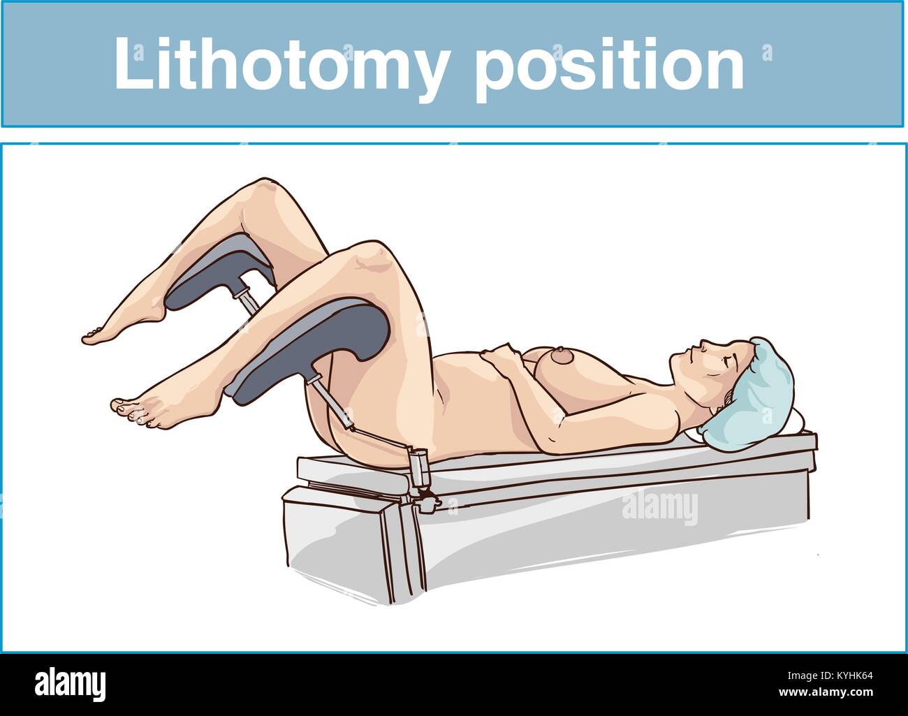 Posizione di litotomia Illustrazione Vettoriale