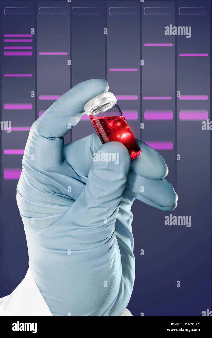 Guanto contiene un liquido campione nella fiala di plastica nella parte anteriore del gel di DNA sfondo Foto Stock