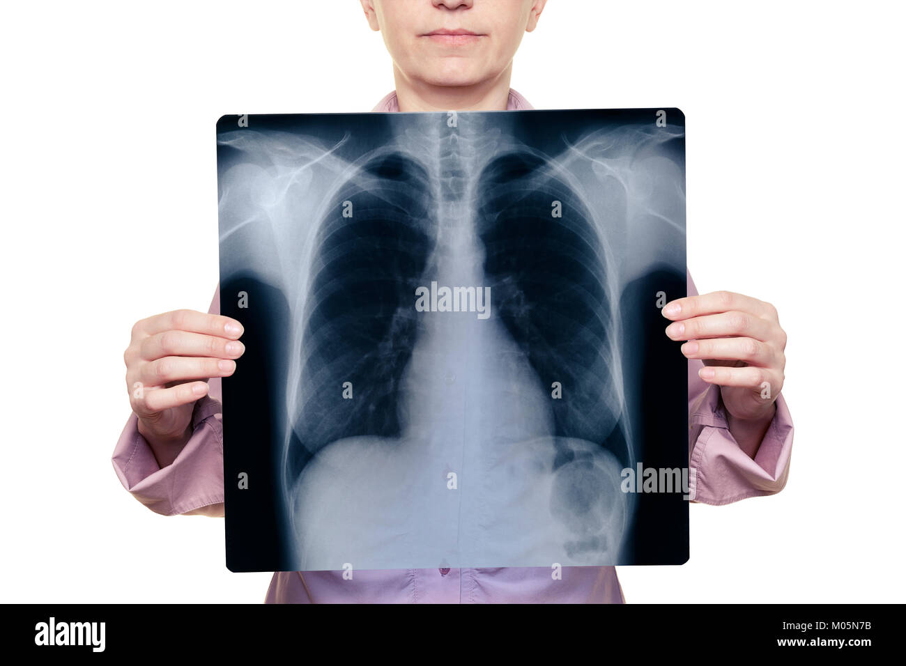Donna che mantiene una radiografia del torace in parte anteriore del suo corpo Foto Stock
