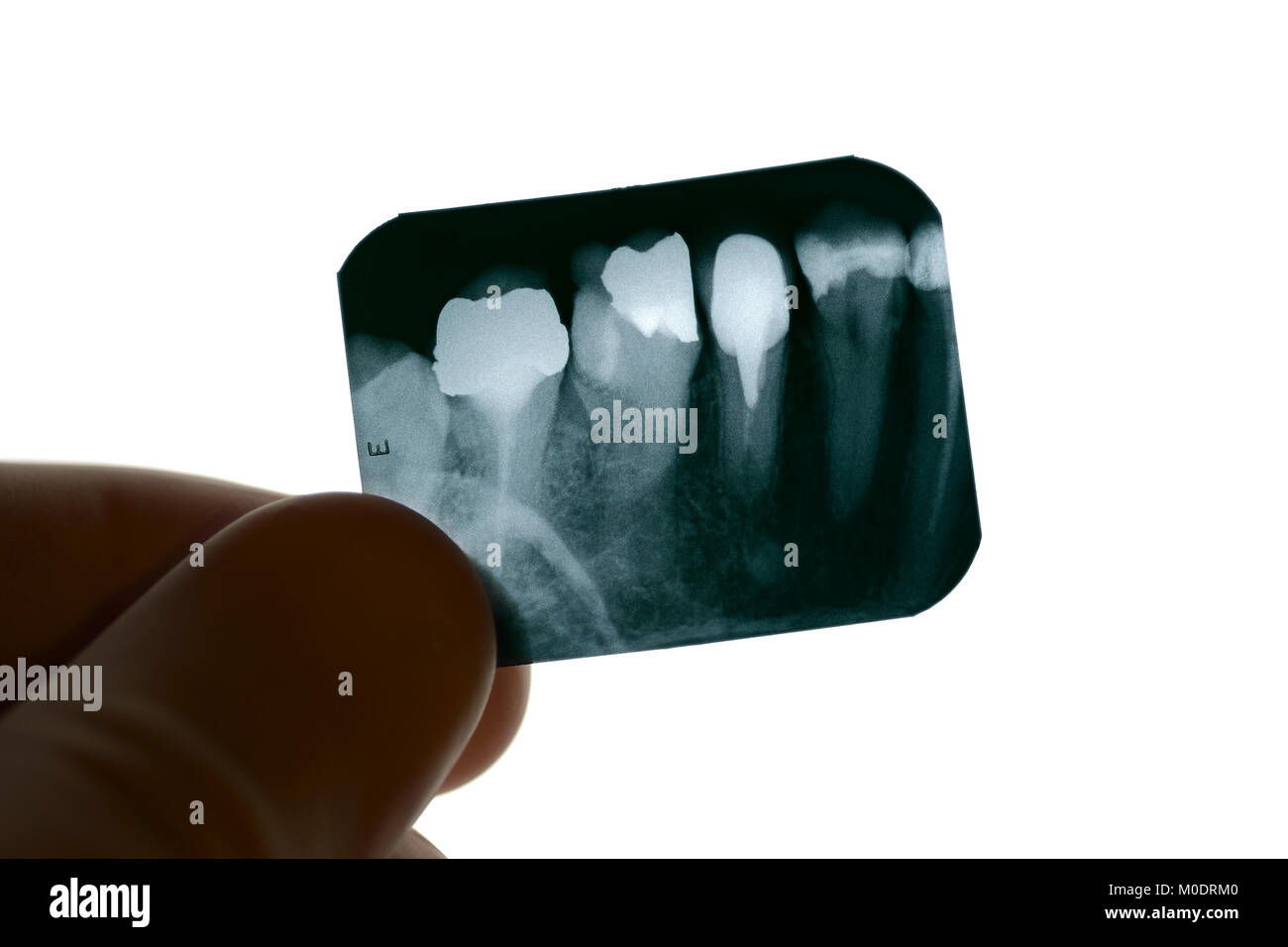 Apparecchiature odontoiatriche a raggi X di essere esaminato da un dentista Foto Stock