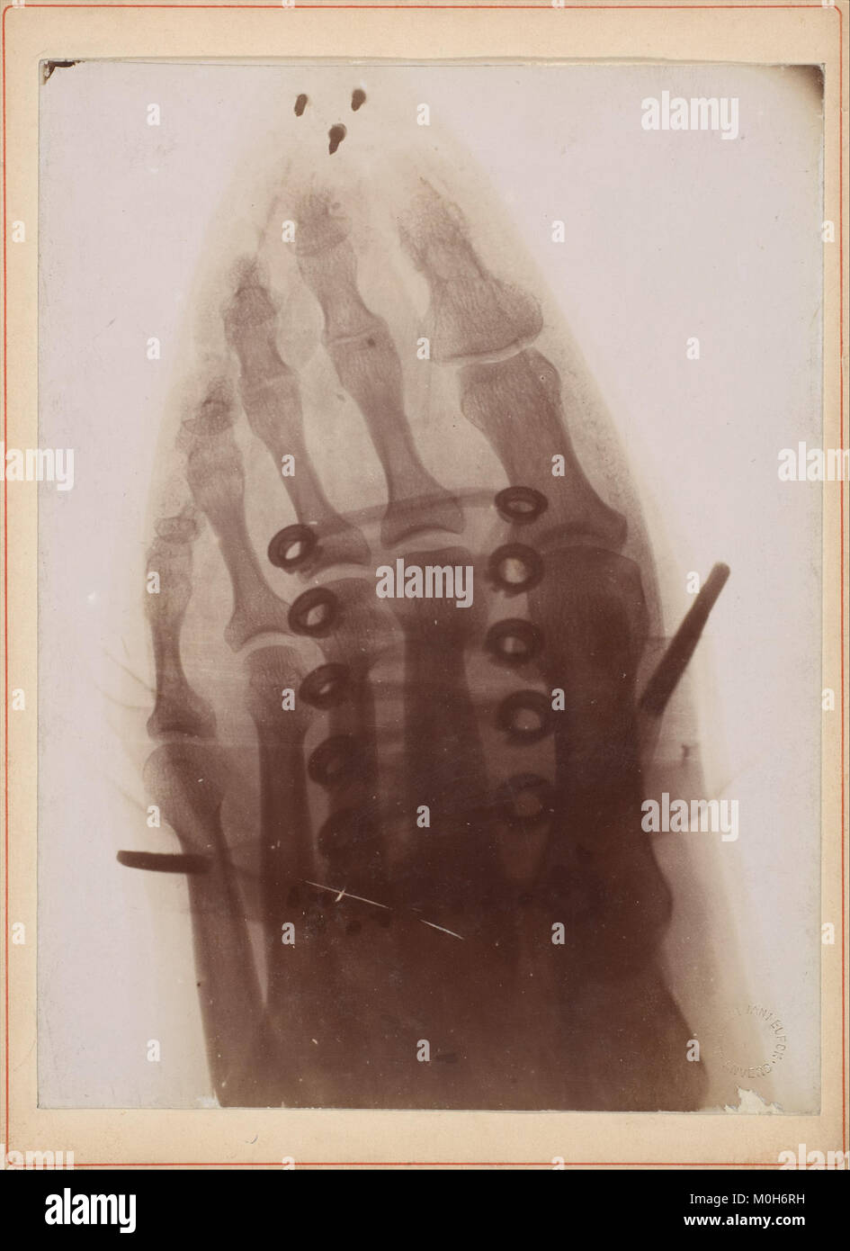 "Le pied à travers la chaussure" è un'opera d'arte concettuale della collezione MET che raffigura un piede umano che interagisce con una scarpa, riflettendo l'esplorazione artistica di forma, movimento e anatomia umana. Foto Stock