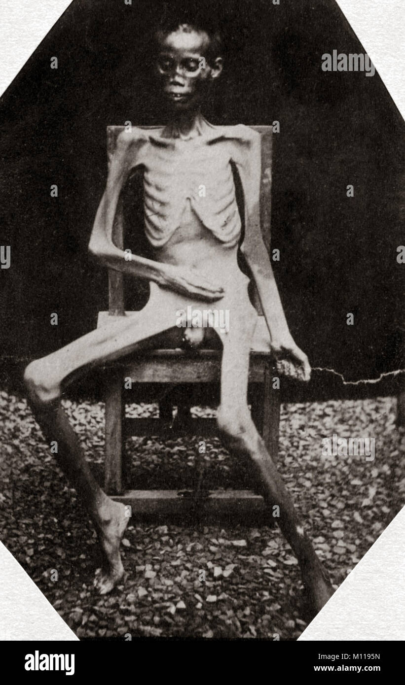 Un tossicodipendente di oppio, fotografato 48 ore prima della morte in carcere di Saigon, Indo-China, Vietnam c. 1880 Foto Stock