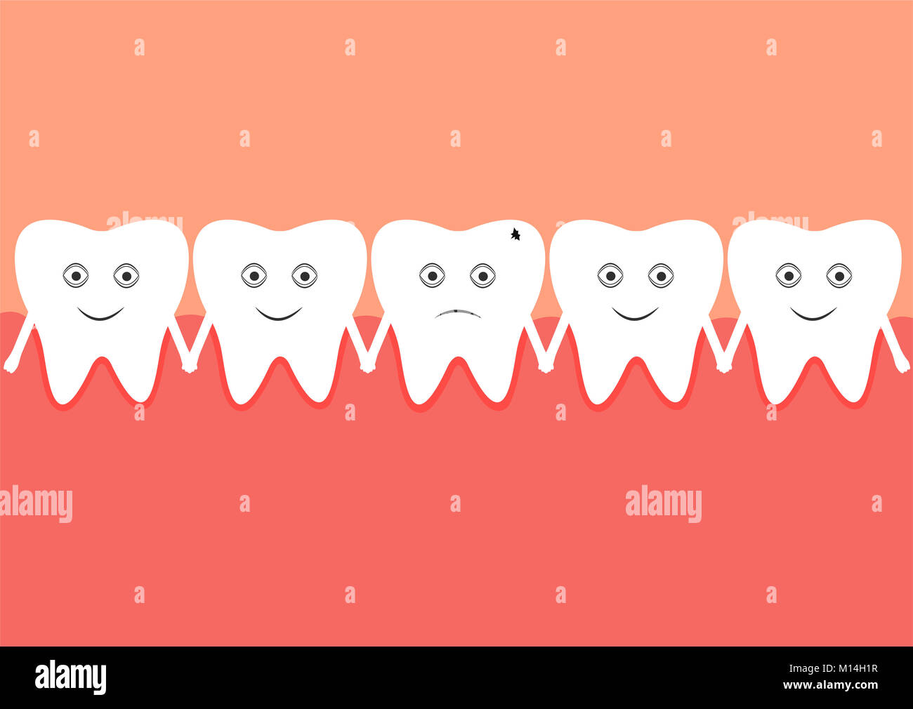 Una fila di denti nella cavità orale. Facile grado di carie Foto Stock