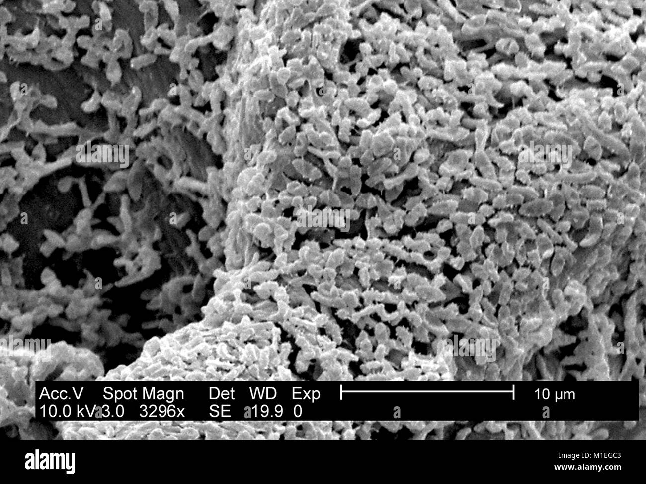 Micrografia SEM di P. mirabilis biofilm (ATCC 29906), Gram-Negative colonia di batteri cresciuti usando un CDC biofilm reattore in PC (policarbonato) coupon, 2003. Immagine cortesia CDC/laboratorio di biofilm, DHQP, Chelsea Samaniego Meltzer. () Foto Stock