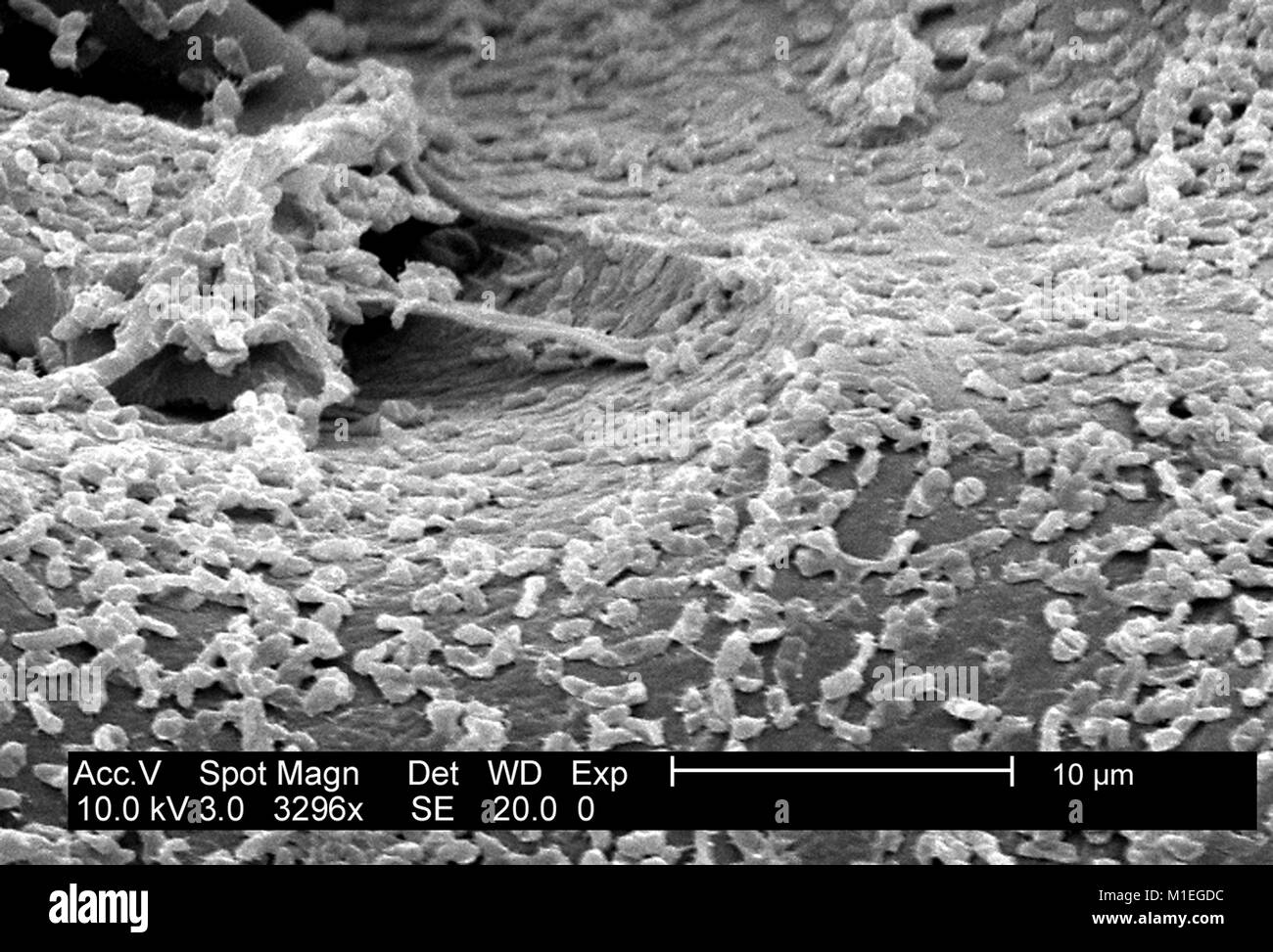 Micrografia SEM di una colonia di batteri Gram-Negative P. mirabilis (ATCC 29906) coltivate su una superficie in policarbonato con un CDC biofilm reattore, 2003. Immagine cortesia CDC/laboratorio di biofilm, DHQP, Chelsea Samaniego Meltzer. () Foto Stock