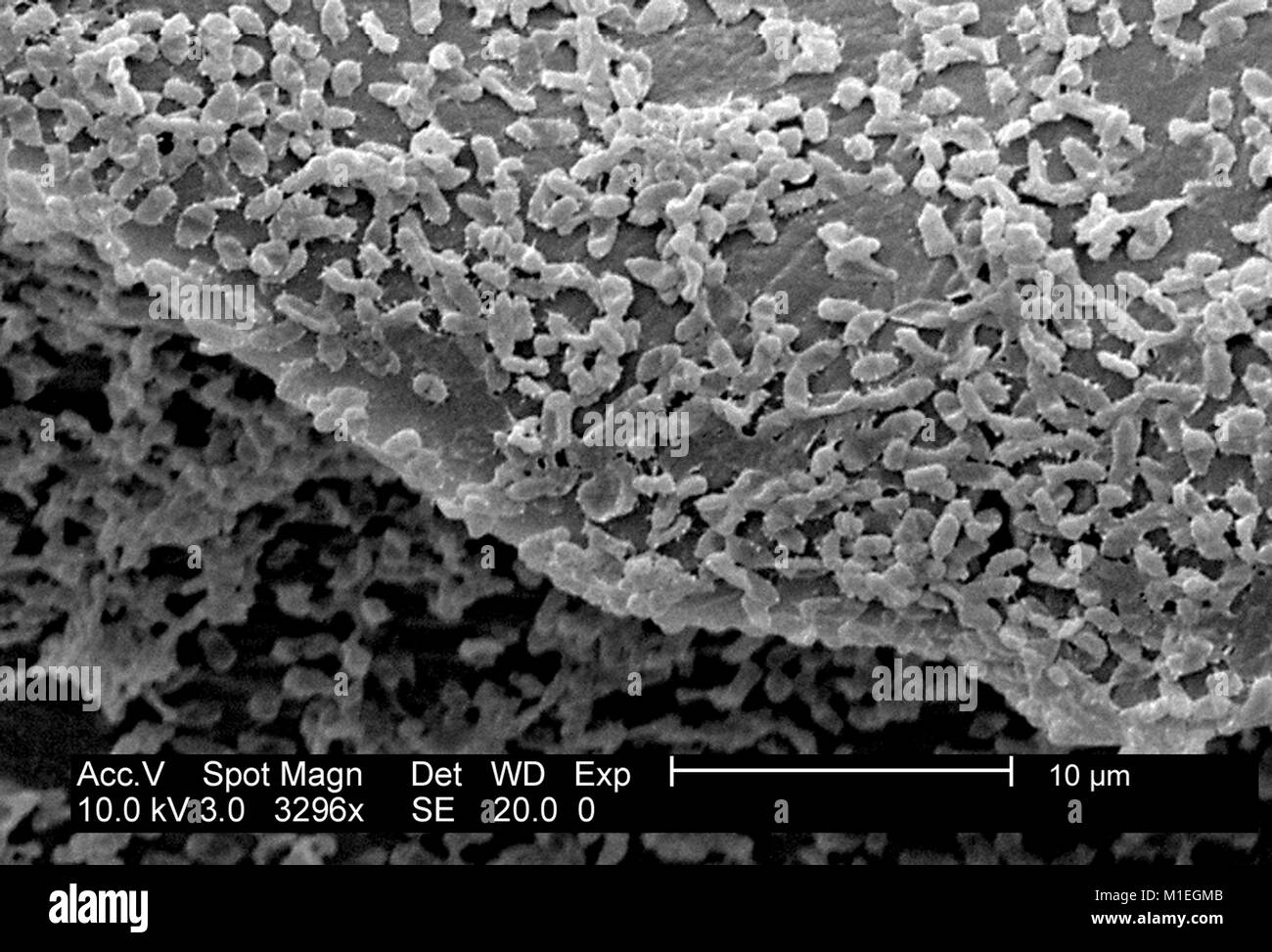 Micrografia SEM di P. mirabilis (ATCC 29906) biofilm, Gram-Negative una colonia di batteri coltivati usando un CDC Reattore a biofilm su PC (polucarbonate) coupon, 2003. Immagine cortesia CDC/laboratorio di biofilm, DHQP, Chelsea Samaniego Meltzer. () Foto Stock