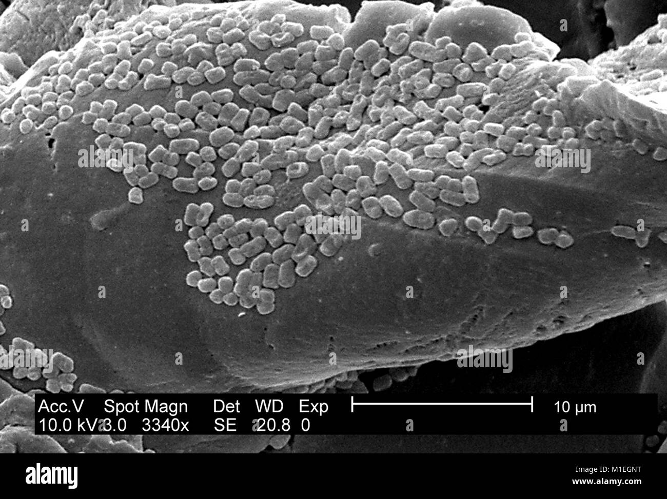 Micrografia SEM di un E.coli (ATCC 11775) biofilm coltivati usando un CDC Reattore a biofilm su PC (policarbonato) coupon, 2003. Immagine cortesia CDC/laboratorio di biofilm, DHQP, Chelsea Samaniego Meltzer. () Foto Stock