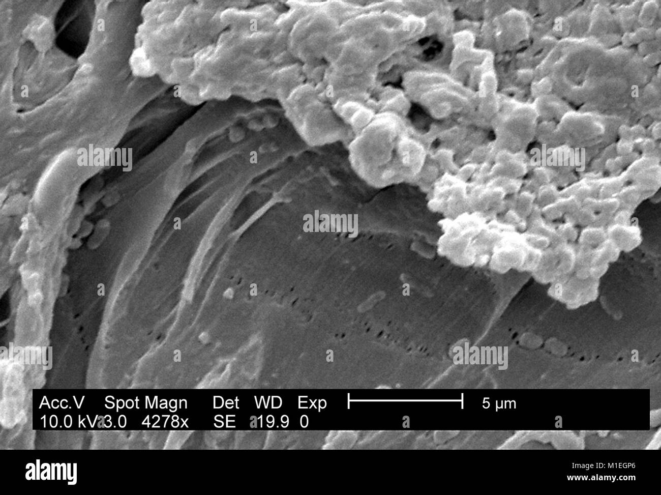 Micrografia SEM di un Escherichia coli (ATCC 11775) biofilm coltivati su PC (policarbonato) coupon utilizzando un CDC biofilm reattore, 2003. Immagine cortesia CDC/laboratorio di biofilm, DHQP, Chelsea Samaniego Meltzer. () Foto Stock