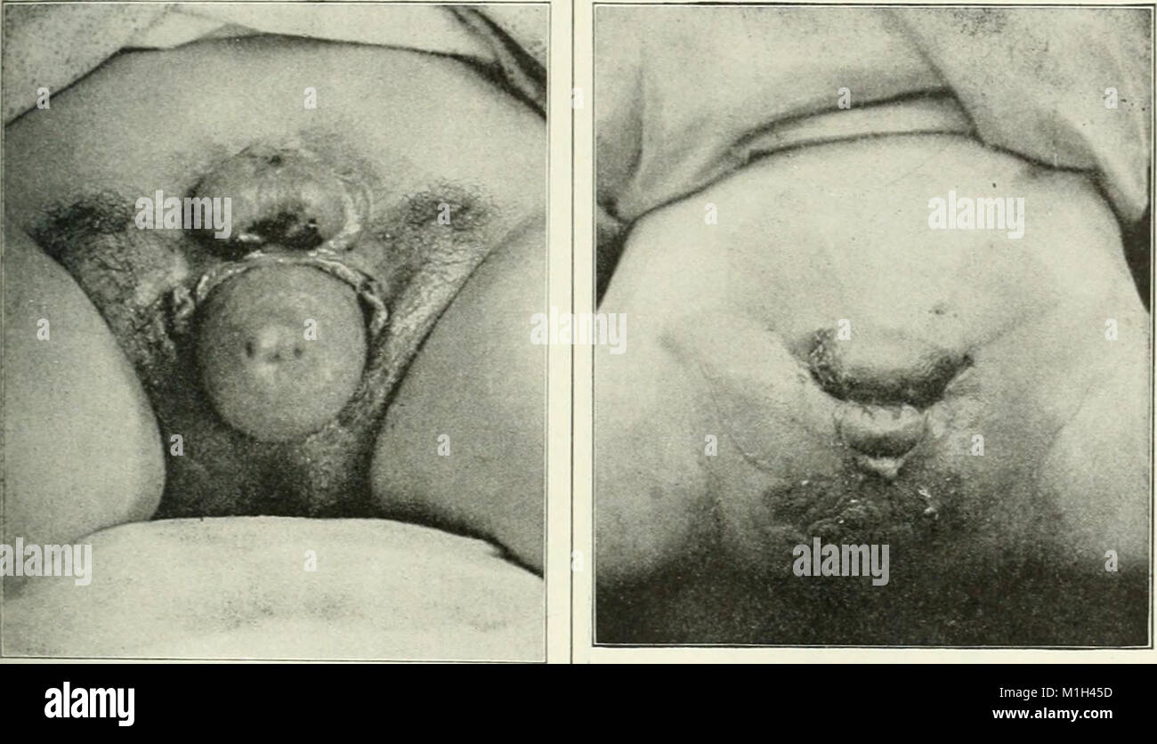 Un manuale di riferimento delle scienze mediche, abbraccia tutta la gamma di scienza e di medicina pratica e allied Science (1913) (14782368572) Foto Stock