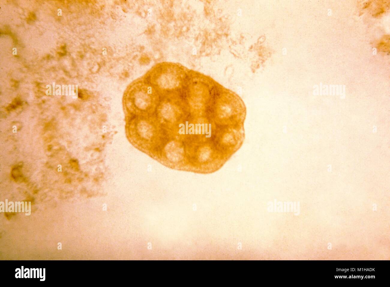 Microfotografia di un uovo pacchetto che è stata rilasciata da una disintegrazione (proglottid tenia segmento), da la pulce tenia specie (Dipylidium caninum), 1979. Immagine cortesia CDC. () Foto Stock