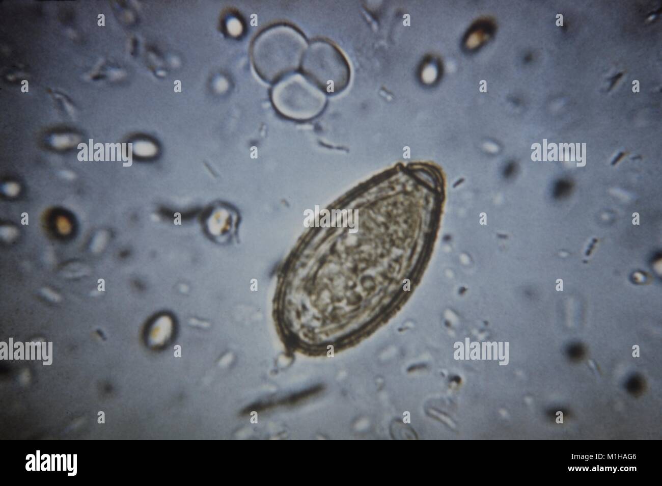 Microfotografia di una flatworm (Clonorchis sinensis) uovo, un trematode parassita o di un fegato umano fluke che provoca la malattia Clonorchiasis, 1979. Immagine cortesia CDC. () Foto Stock