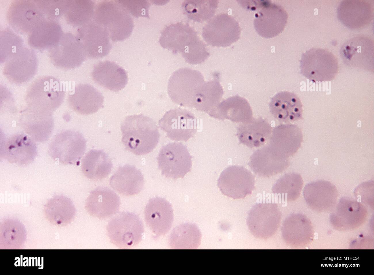 Plasmodium falciparum anelli trovati in uno striscio di sangue microfotografia, 1971. Immagine cortesia di centri per il controllo delle malattie (CDC) / Il Dottor Mae Melvin. () Foto Stock