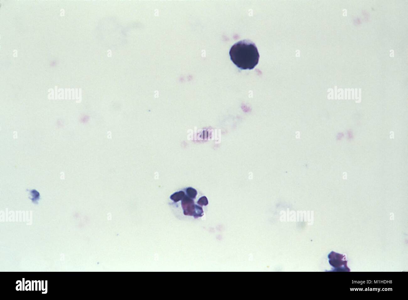 Microfotografia di un artefatto che assomiglia a un Plasmodium falciparum gametocyte, 1980. Immagine cortesia CDC/Dott. Mae Melvin. () Foto Stock