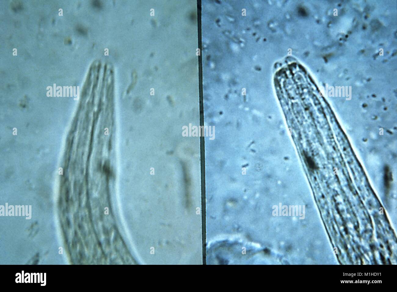Hookworm e strongyloides, apparato boccale di rhabditiform staged larve ha rivelato nella micrografia film, 1982. Immagine cortesia di centri per il controllo delle malattie (CDC) / Dr Mae Melvin. () Foto Stock