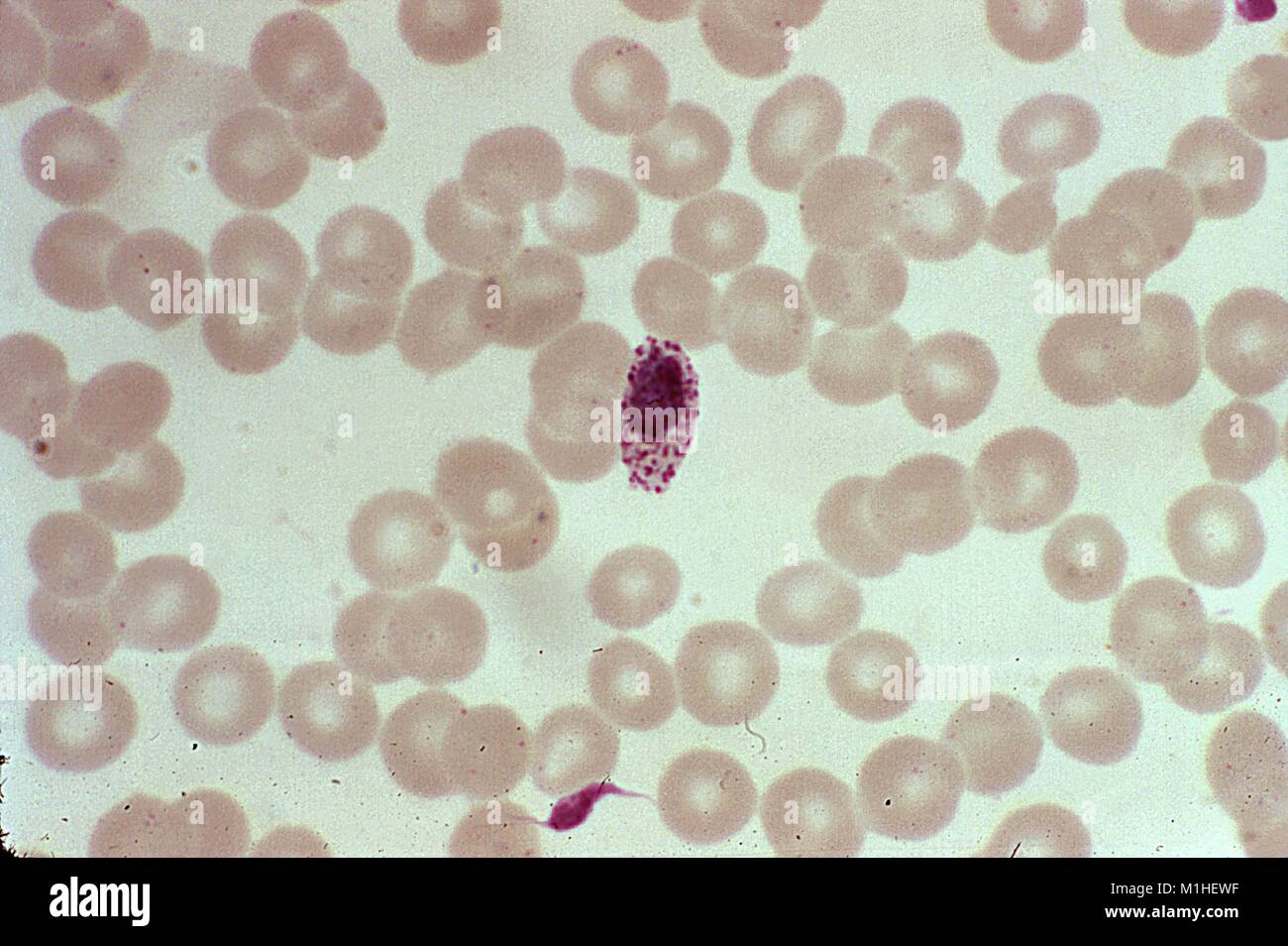 La fotomicrografia del parassita della malaria Plasmodium ovale nella sua giovani immaturi di schizonte stadio, 1973. Immagine cortesia CDC/Dott. Mae Melvin. () Foto Stock