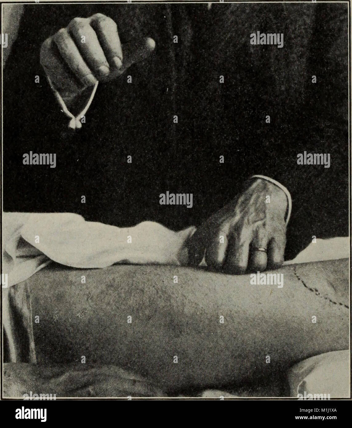 Un manuale di esercizi terapeutici e massaggi, progettato per l'uso di medici, studenti e massaggiatori (1917) (14597634090) Foto Stock