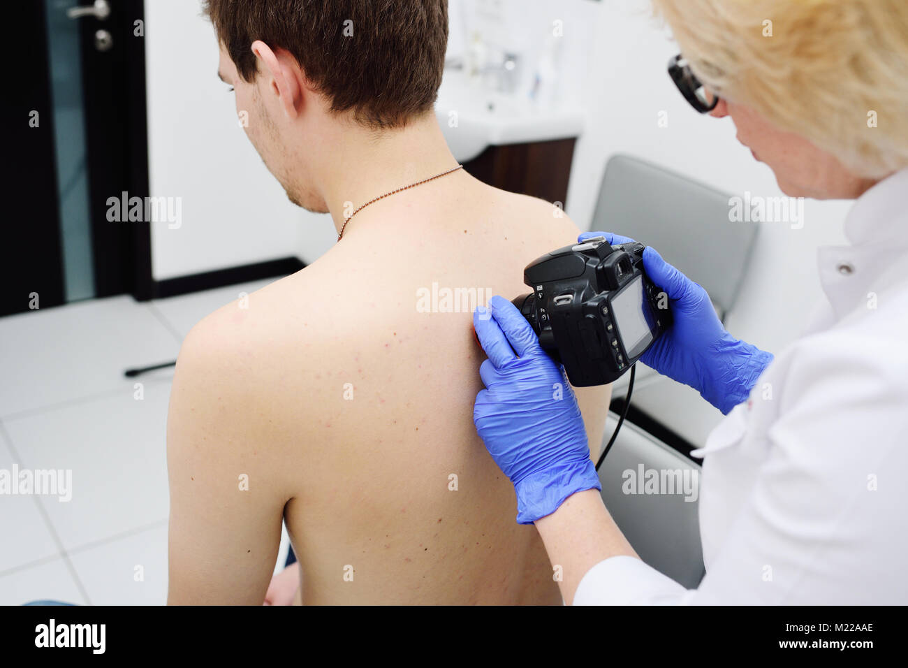Il medico dermatologo esamina e birthmarks birthmarks del paziente con un dermatoscope Foto Stock