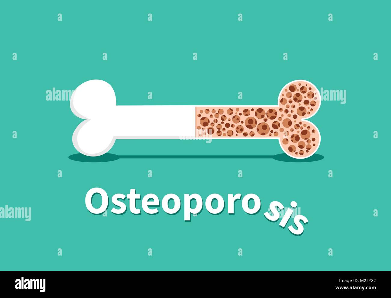 L'osteoporosi, la struttura ossea in vector art design Illustrazione Vettoriale