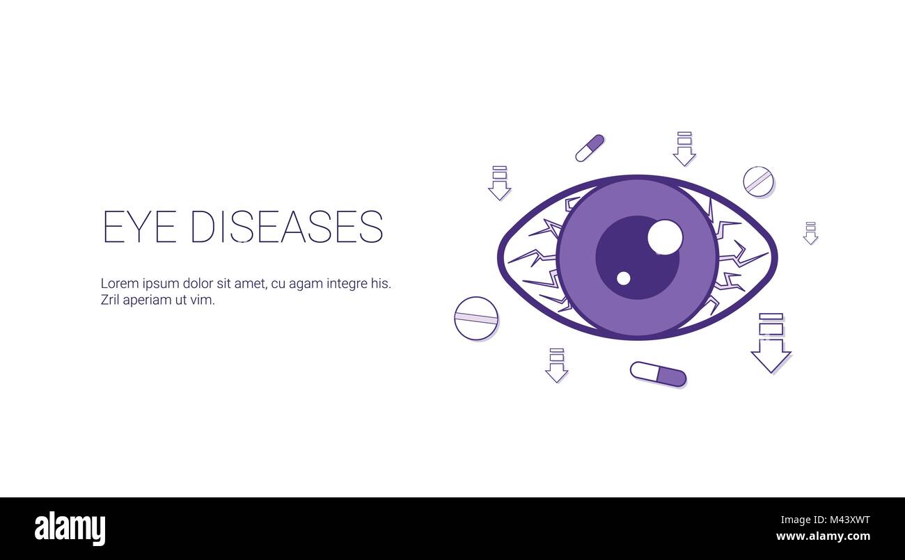 Malattie degli occhi di banner per il Web con spazio copia Health Care Concept Illustrazione Vettoriale