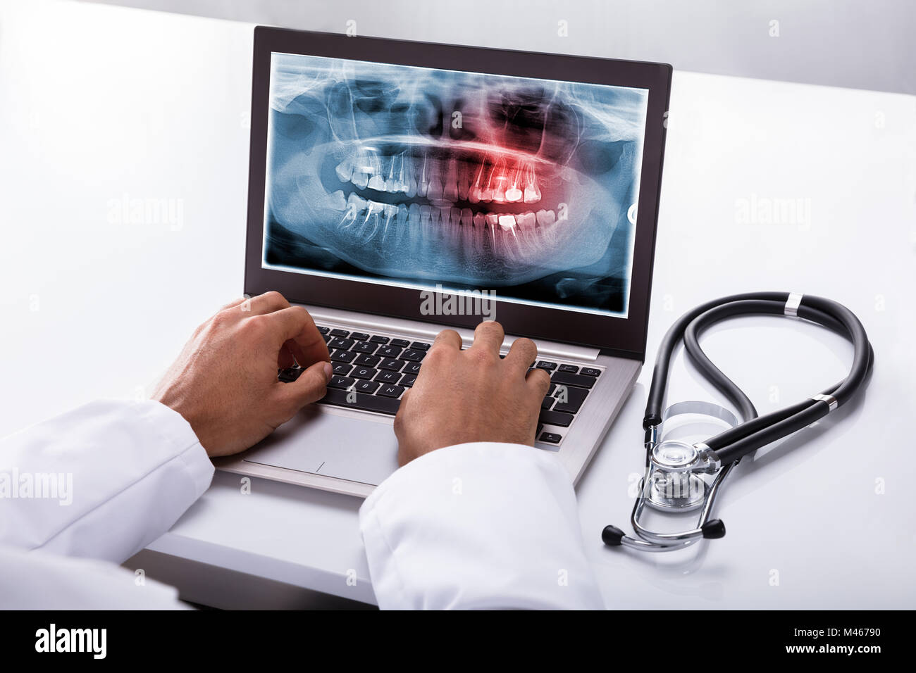 Close-up di un dentista la mano digitando su laptop con apparecchiature odontoiatriche a raggi X sullo schermo Foto Stock