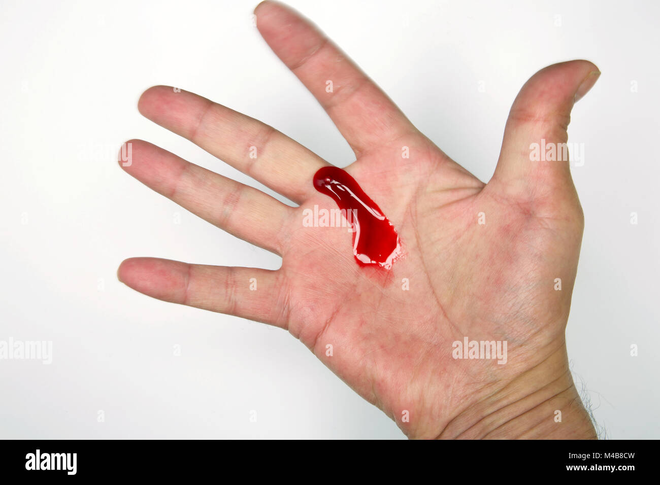 Il sangue sulla mano. Foto Stock