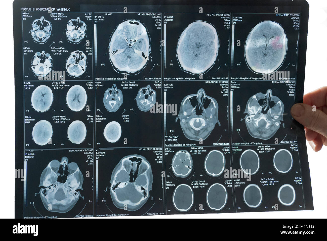 X-ray immagine del cervello in mano del medico su sfondo bianco Foto Stock