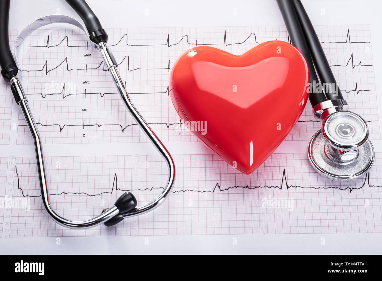 Vista in elevazione del Cardiogram con cuore rosso e uno stetoscopio Foto Stock