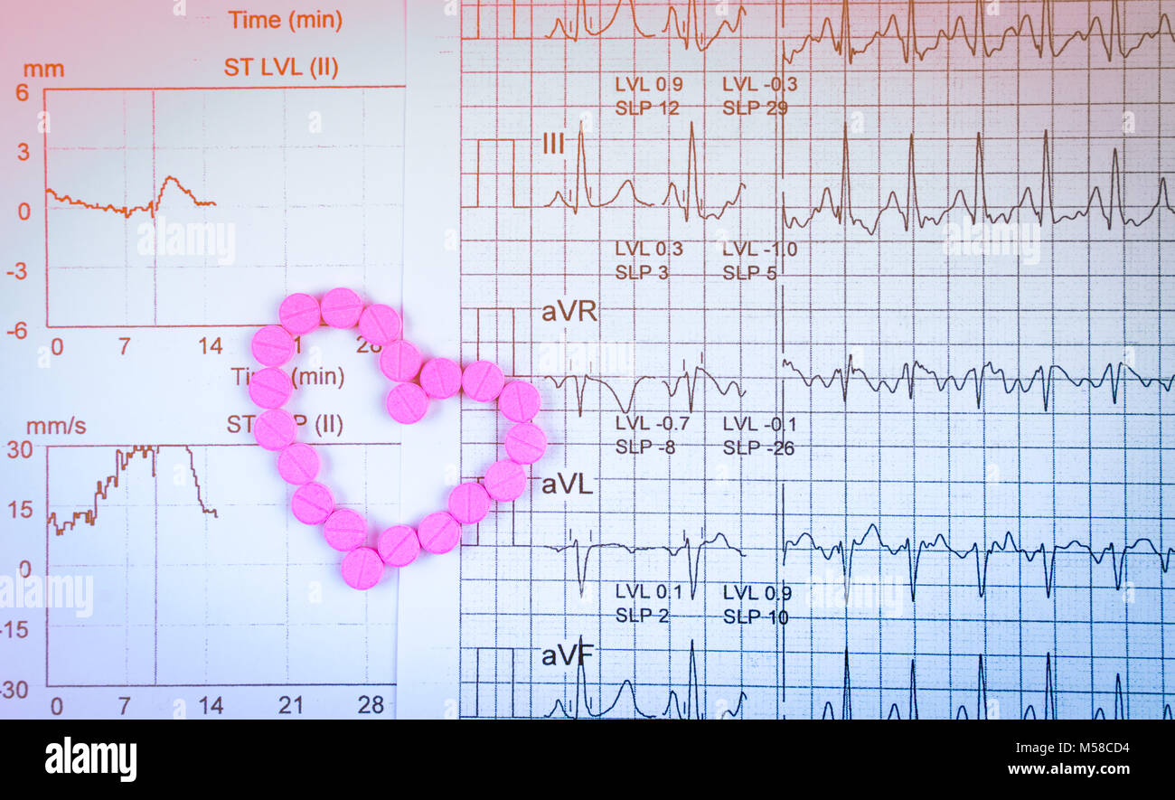 Elettrocardiogramma o ECG (elettrocardiogramma) rapporto grafico di carta. EST ( esercizio Stress Test ) Risultato e cuore rosa forma resa da pillole. Pacchetto promozione per hea Foto Stock