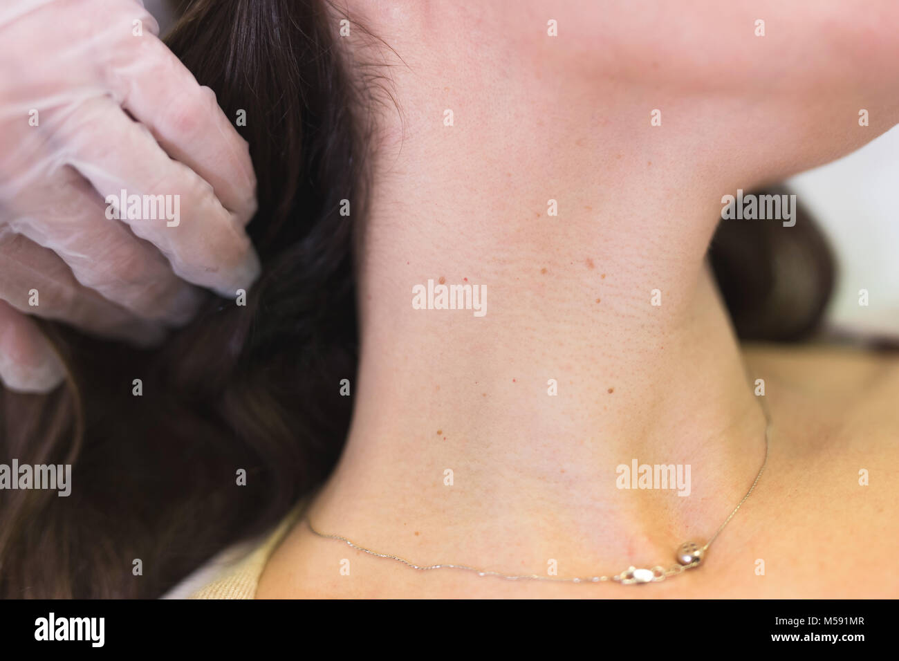 Dermatologia consultazione Foto Stock