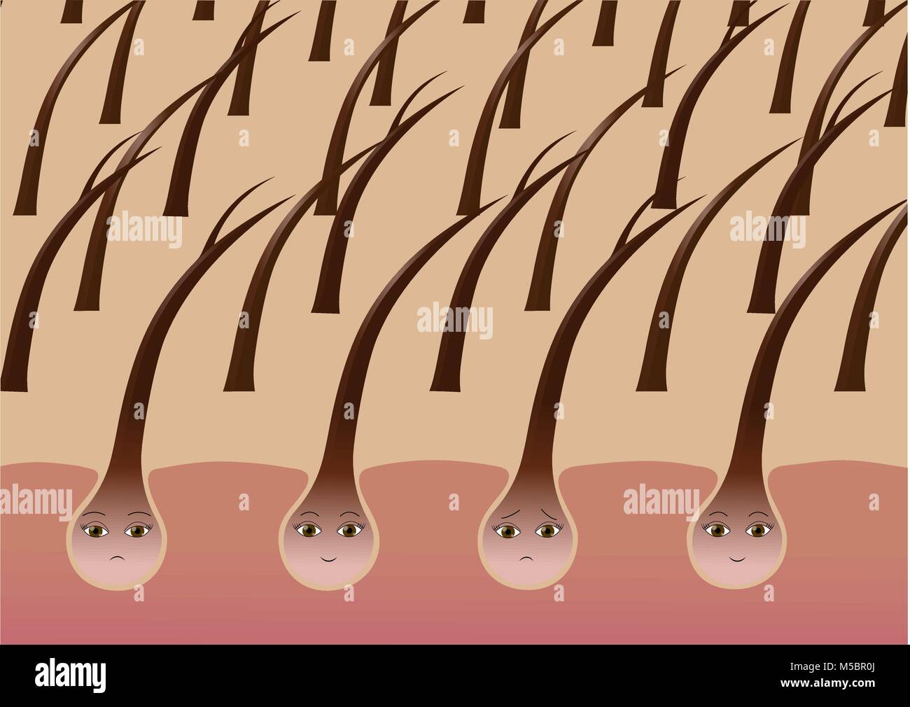 Cartoon follicoli dei capelli sul cuoio capelluto soffre di doppie punte Illustrazione Vettoriale